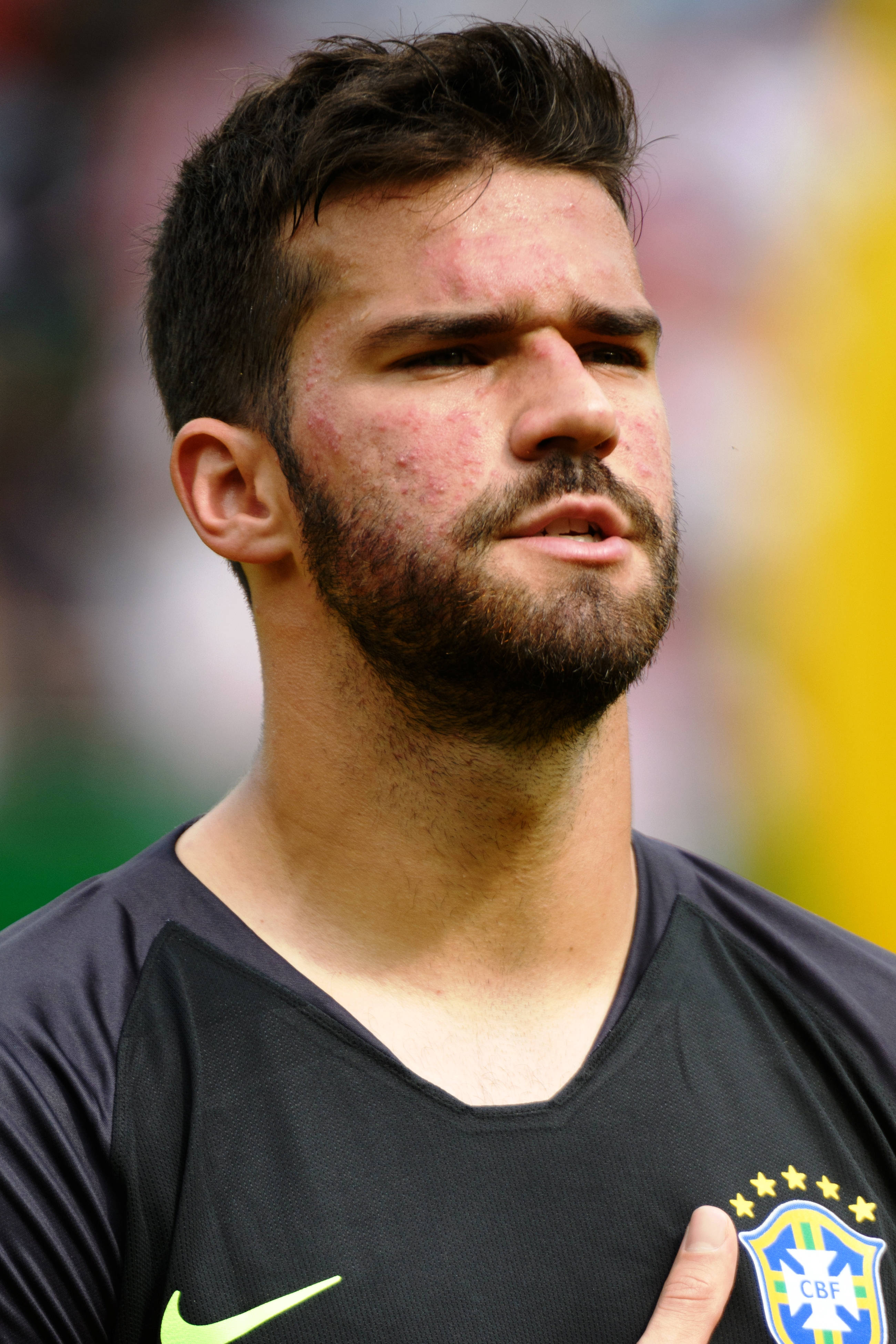 Perfil cercano de Alisson Becker Fondos de pantalla