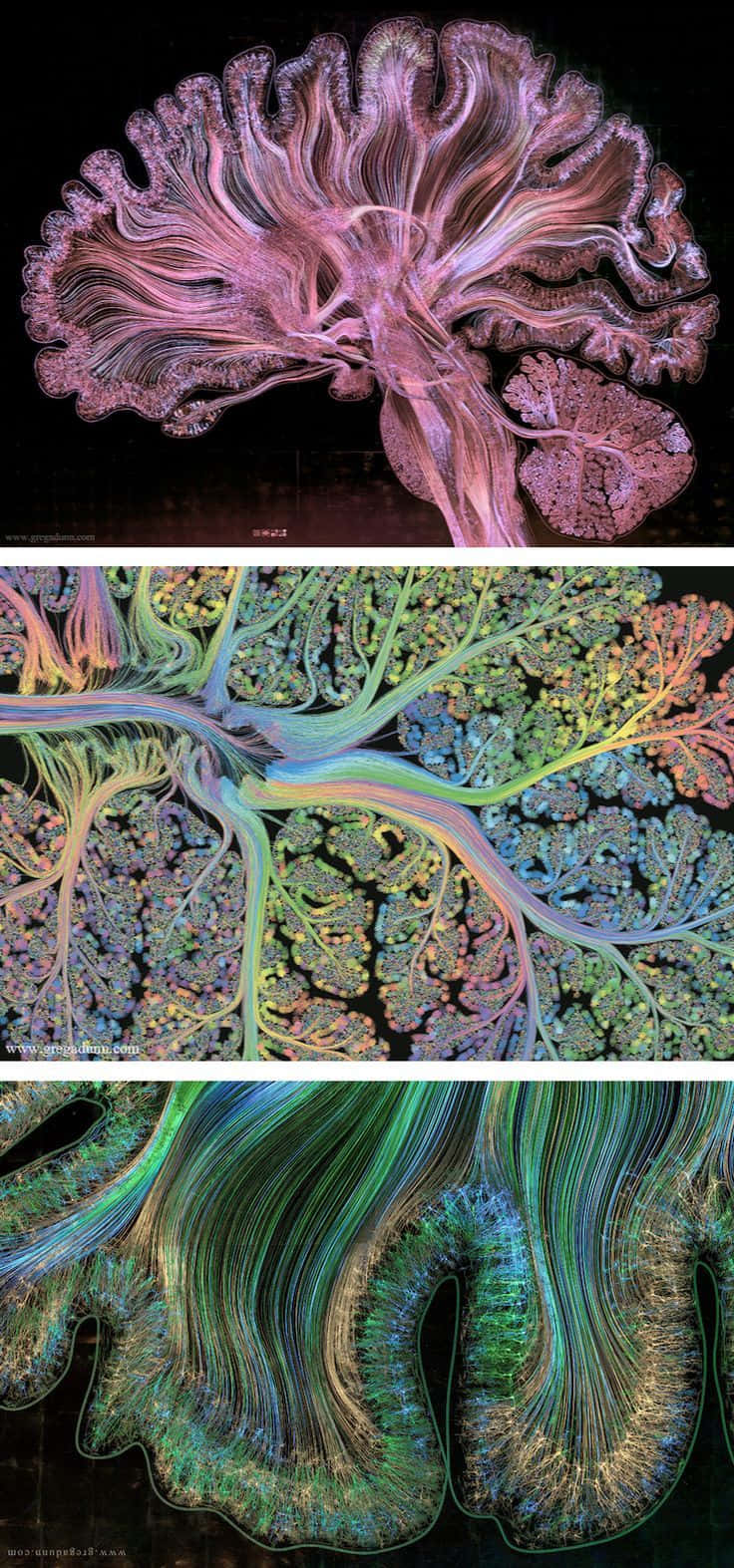 una serie de imágenes del cerebro Fondos de pantalla